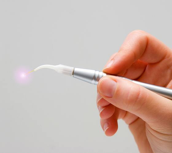 Hand holding a soft tissue dental laser