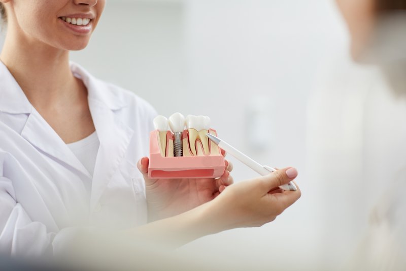 dentist explaining dental implant model